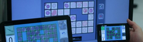 Juega para ayudar a la investigación mundial contra la malaria