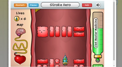 Stroke Hero, un videojuego con el que aprender a detectar un ictus